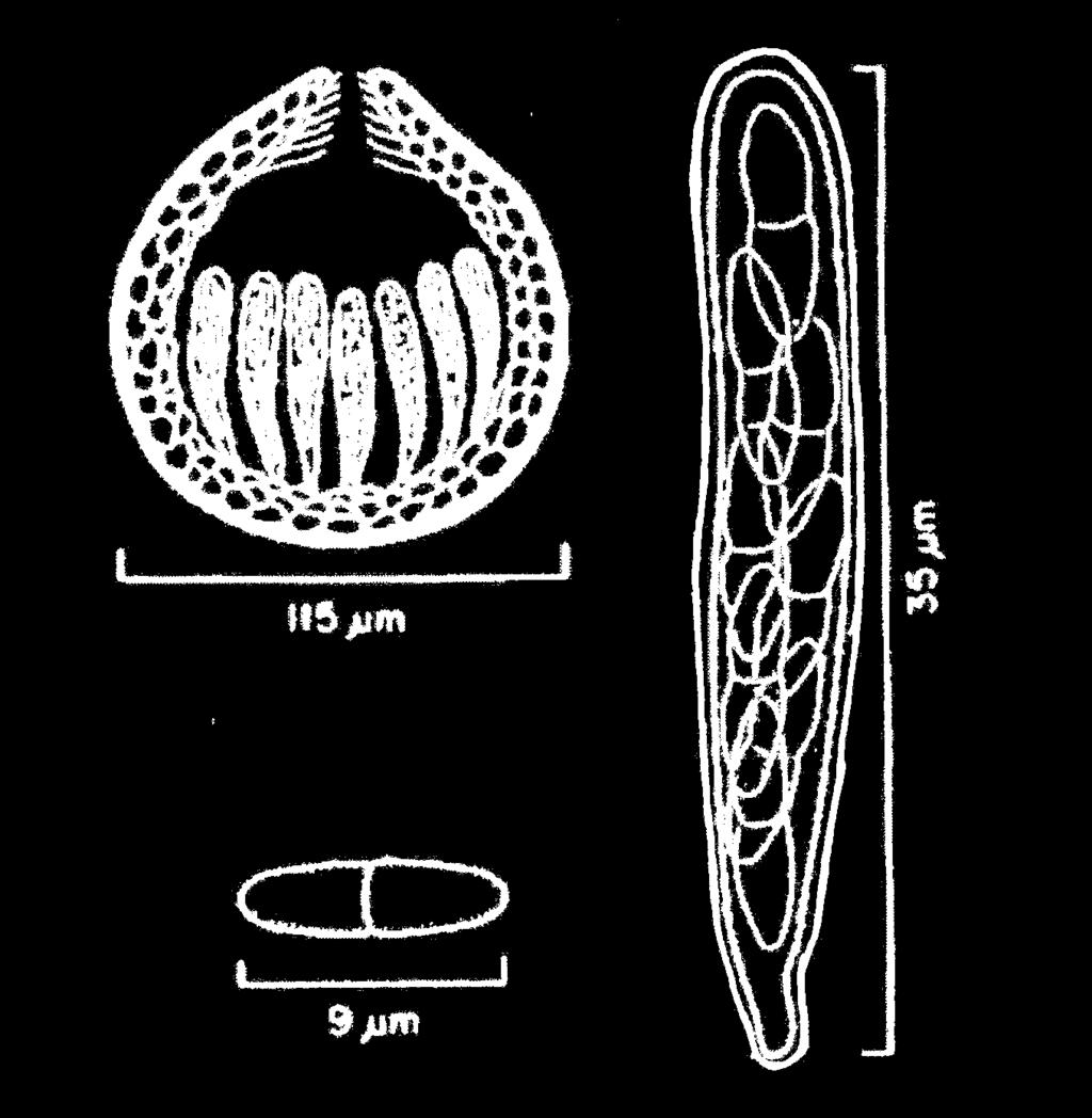epresentação ilustrativa de conidióforos e conídios de Pseudocercospora fijiensis (Fonte: Ninoska,