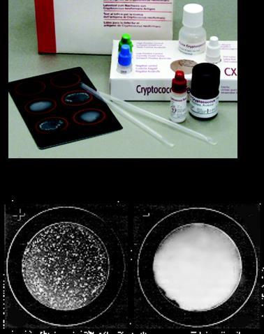 Prova do Látex Para antígenos capsulares do Cryptococcus sp.