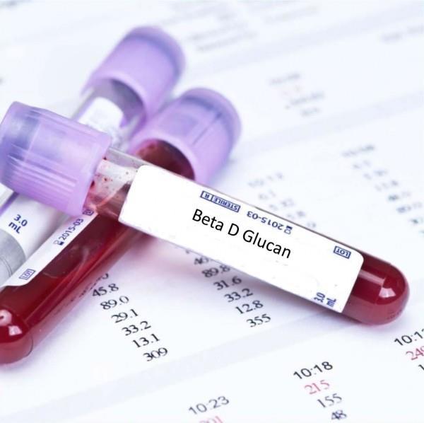 (1,3)β-D-Glucan (1,3)-β-D-Glucan não é específico para Aspergillus Útil como screening