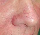 discromias, melasma, cicatrizes de acne e cirúrgicas, rugas, poros,