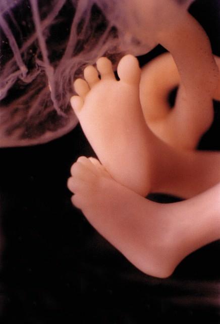 MAS QUEREM QUE AS MULHERES QUE ABORTAM VÃO PARA A CADEIA?