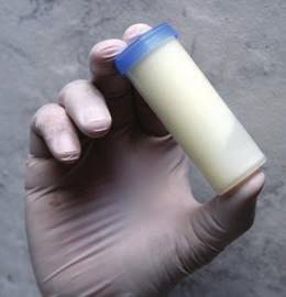 do laboratório. Alguns laboratórios fornecem o frasco com conservante em pastilha.