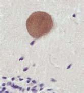 4 A B FIGURA 1 - Fases do ciclo biológico de N. caninum. (A) Cisto tissular em cérebro, procedente de feto bovino abortado (imunoistoquímica x400).