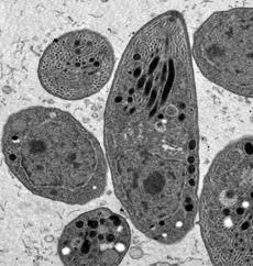 Fonte: COLLANTES - FERNÁNDEZ (2003) Os cistos teciduais são ovais, com aproximadamente 107 µm de comprimento, e já foram observados principalmente em tecido nervoso (cérebro, medula espinhal,