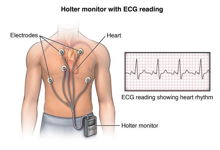 Tele-laudo Holter 24h POP colocação do equipamento Orientações aos pacientes Pedido médico e relatórios de