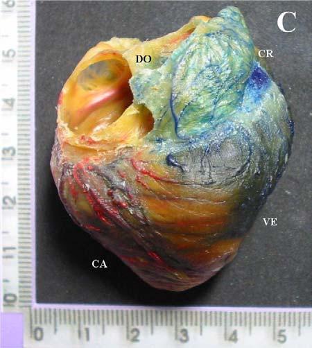 1758) 57 Os vasos em Vermelho evidenciam os ramos da artéria coronária