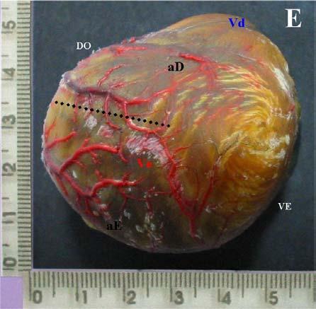 interventricular (TRACEJADO) e ventrículo esquerdo (Ve).