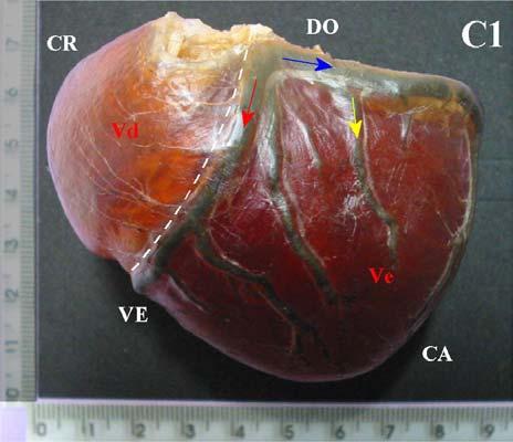 Vascularização Arterial dos Músculos Papilares do Ventrículo Esquerdo de cães (Canis