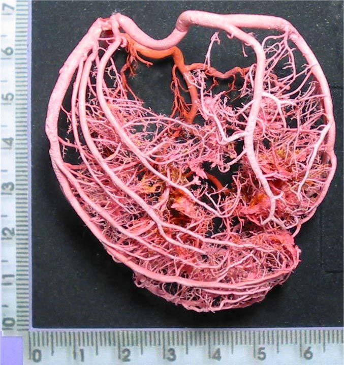 Vascularização Arterial dos Músculos Papilares do Ventrículo Esquerdo de cães (Canis familiaris, L.