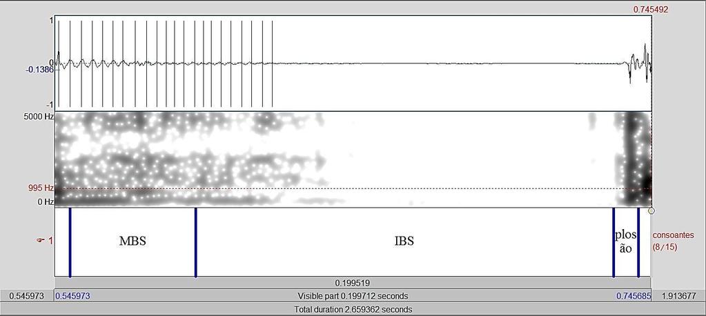 Figura 16 Exemplo de produção de uma consoante vozeada [C1] com os elementos [MBS], [IBS] e [Plosão] produção de S3: