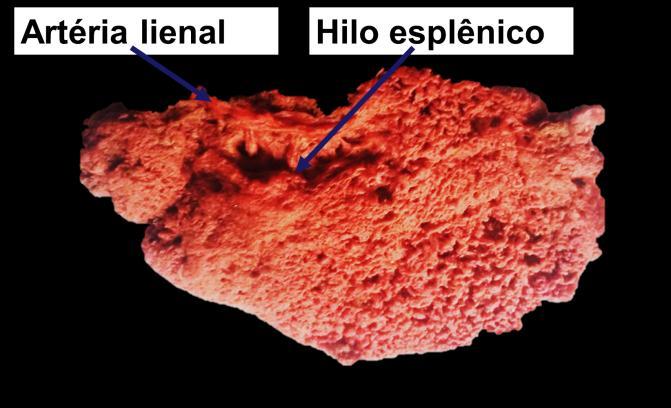 Os baços ficaram imersos em água por 24h e depois em ácido clorídrico (HCl) a 30% por mais 48h para a obtenção dos moldes vasculares (Fig.