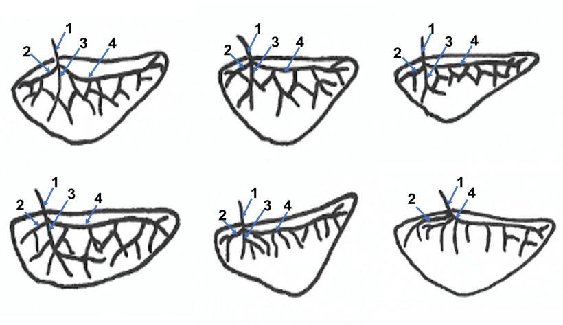 Figura 2 - Desenhos esquemáticos do comportamento da artéria lienal (1) da paca (Cuniculus paca), visto pela face visceral, onde se verificam os ramos arteriais caudal (2), ventral (3) e cranial (4),