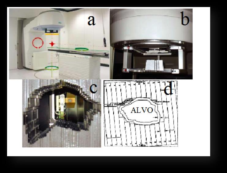 85 baixo ponto de fusão (cerrobend 15 ) para cada incidência do equipamento, entre o foco do feixe e o paciente, permitindo a proteção das estruturas que não se pretendiam irradiar.