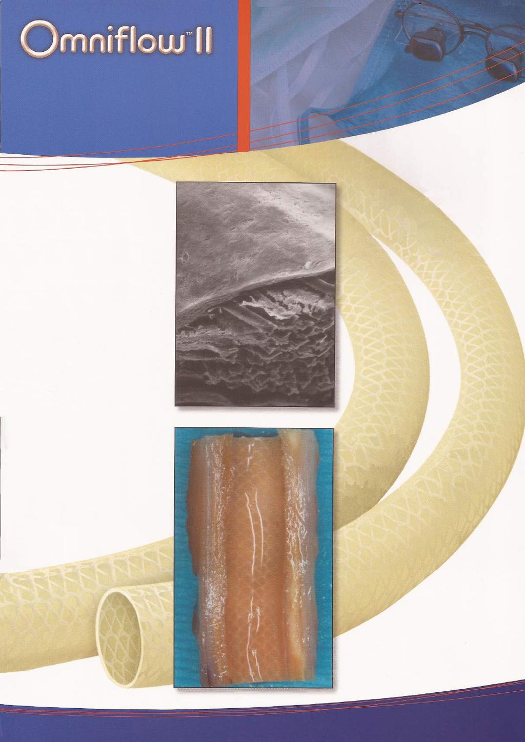 Micrografia eletrônica de varredura mostrando a fina camada do fluxo da superfície do material biológico estável, cobrindo a malha de