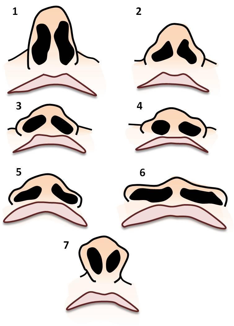 38 4 Material e Métodos Figura 6 - Tipos de narinas.