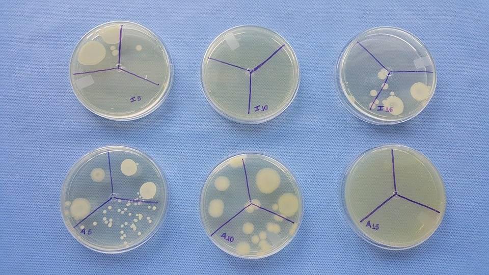 17 Figura 10 - Placas de Petri referentes às amostras borrifadas com Álcool 70% e mantidas por 5, 10 e 15 minutos Tabela 1 - de crescimento ou não crescimento bacteriano nas placas de Petri: