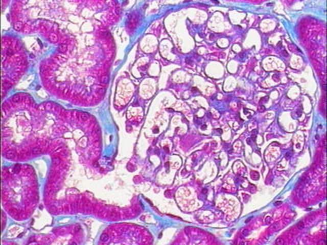 Membrana Basal e  PAMS