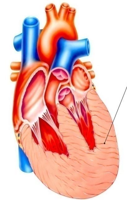 CARDIOPATIA 