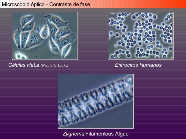 Outros tipos de microscópio