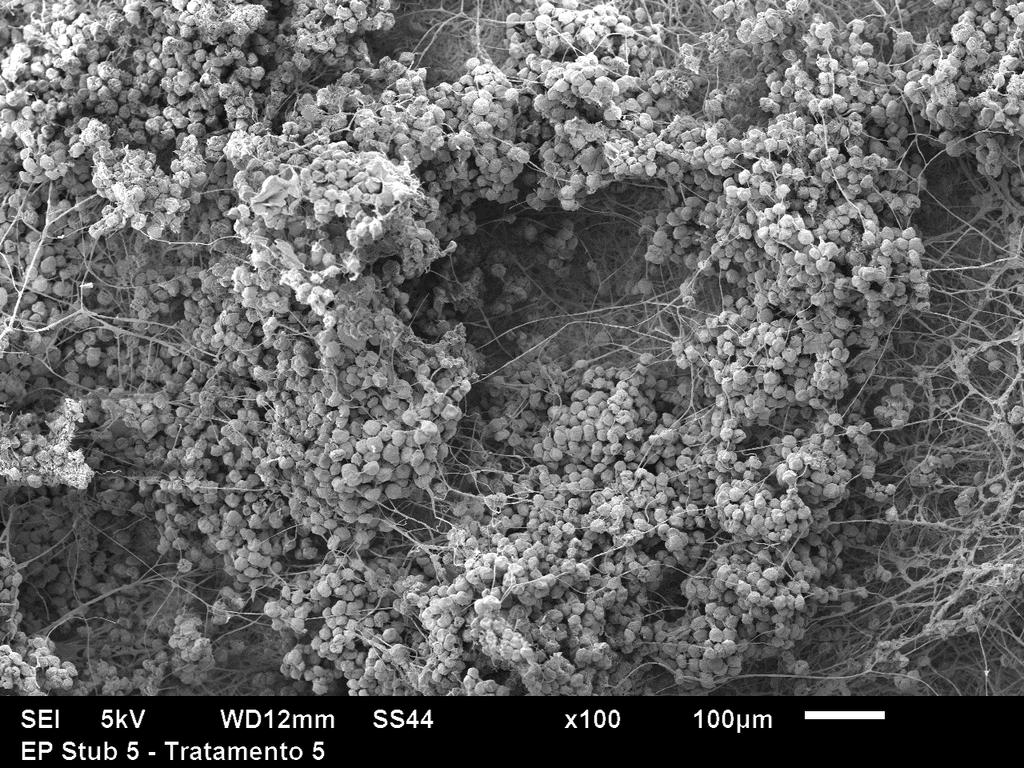 Outros tipos de microscópio Microscópio eletrônico de varredura (MEV) Esporos e hifas