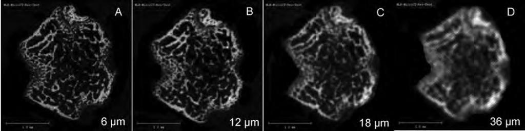 3 - REVISÃO DA LITERATURA imagens, com incremento de grau em função da altura, utilizando o algoritmo de Feldkamp modificado (FELDKAMP et al., 1989).