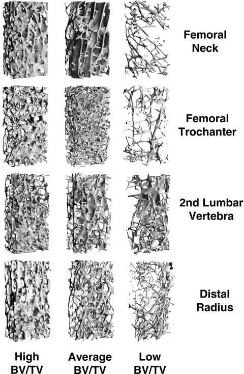 3 - REVISÃO DA LITERATURA com 26 µm (isotrópico), o que possibilitou visualizar a variação em cada local (NAGALE et al., 2004). Figura 3.