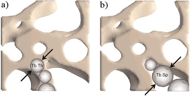 3 - REVISÃO DA LITERATURA para imagens 2D de ossos trabeculares (HAHN et al., 1992). Indica o grau de convexidade/concavidade relativa da superfície óssea, influênciado pela BV/TV.