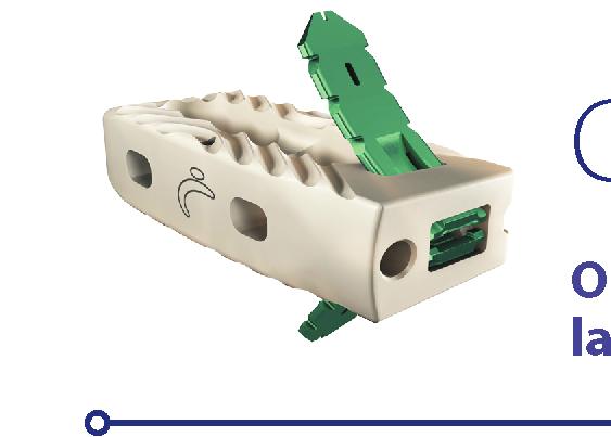 automático Simplicidade Porta Implante desenvolvido para introduzir tanto o cage quanto as Âncoras VerteBRIDGE.