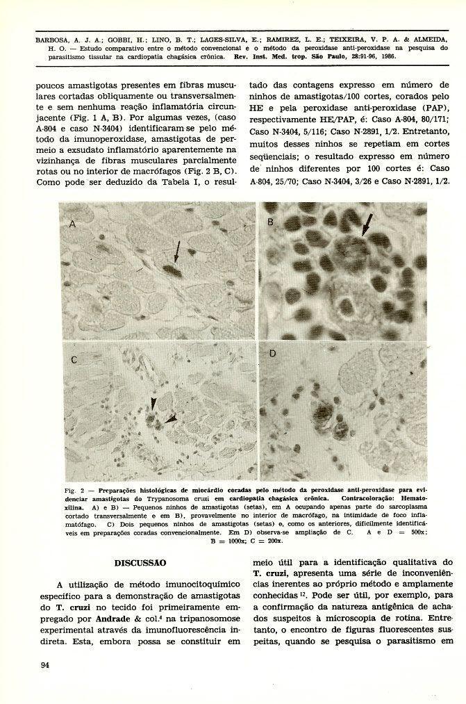 poucos amastigotas presentes em fibras musculares cortadas obliquamente ou transversalmente e sem nenhuma reação inflamatória circunjacente (Pig. 1 A. B).