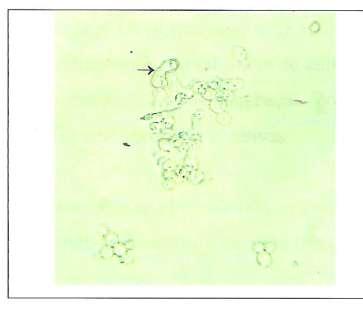 Haploid cells forming shmoos