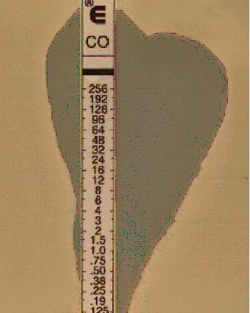 E-test Principio - Gradiente de difusão do agente no ágar Teste - Semear superfície da placa com micro-organismo - Swab - Suspensão 1-2 x 10