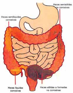 ASSISTÊNCIA À PESSOA COM ESTOMA INTESTINAL OU URINÁRIO A bexiga é um órgão muscular oco que armazena a urina que, posteriormente, será eliminada através da uretra.