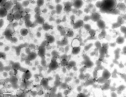 16 Micrografias obtidas por MET do látex S1 com