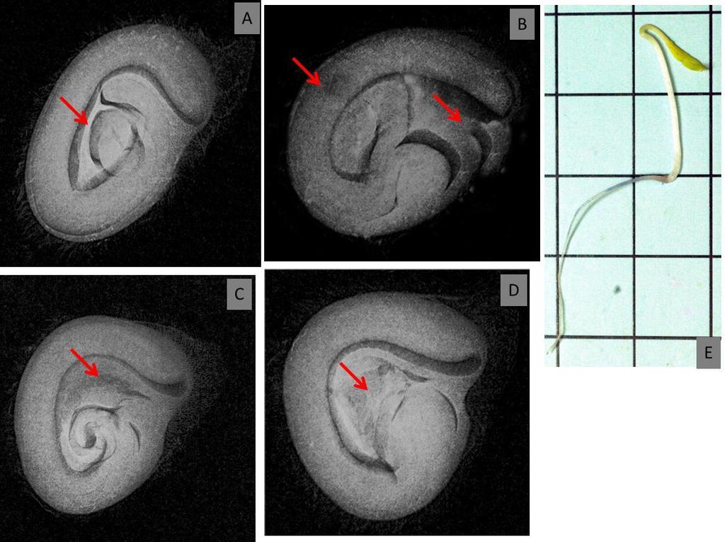 deterioração (A, B e C ) que originaram plântula normal (D) Figura 2.