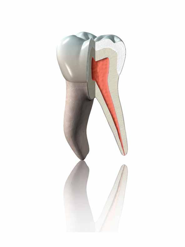 COMO O DENTE NATURAL O compósito restaurador perfeito caracteriza-se por propriedades físicas semelhantes às dos dentes naturais, combinadas a ótimas qualidades de manuseio e a uma estética natural.