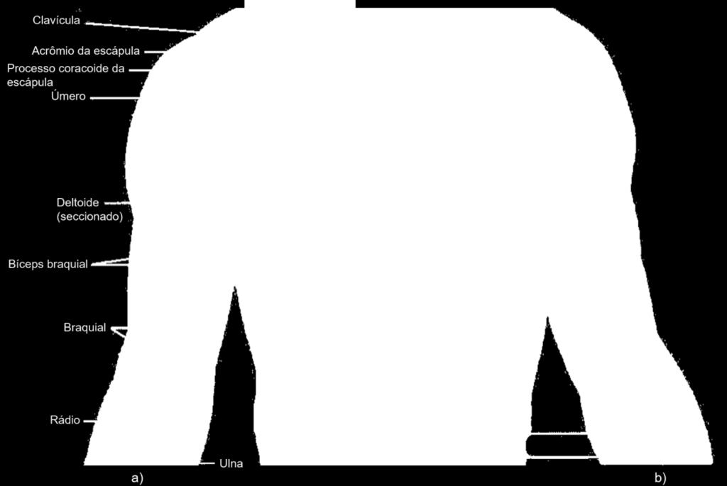 e na Figura 3), flexor radial do carpo, flexor ulnar do carpo, palmar longo, extensor radial longo do carpo e extensor ulnar do carpo.