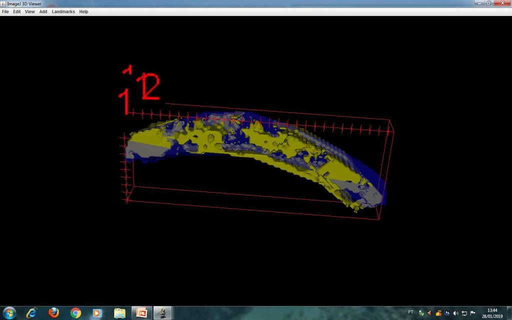 Uma vez obtida a imagem em 3D, todas as ferramentas do 3D Viewer podem ser utilizadas e empregadas, como exemplo, mundança de cores, rotação e translação da imagem, além da gravação de vídeos.