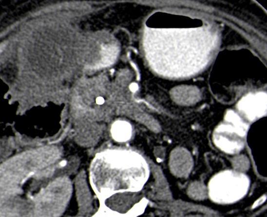 Cirurgia