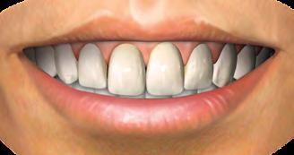 Ortodontia com Excelência n a b u s c a d a p e r f e i ç ã o c l í n i c a Uma alteração,