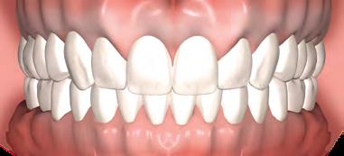 A geração atual de pacientes é mais exigente, buscando não só um posicionamento adequado de seus dentes, mas mostrando também uma