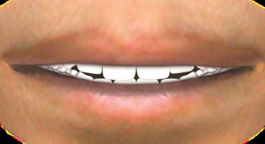 Ortodontia com Excelência n a b u s c a d a p e r f e i ç ã o c l í n i c a O planejamento do tratamento deve levar