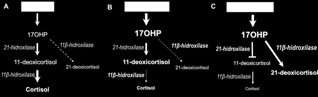 à redução na síntese de 21-deoxicortisol (21-DF); C: RN afetado pela HAC-21OH, com atividade reduzida da 21-hidroxilase, com consequente acúmulo de 17OHP e desvio para a síntese de 21-DF, por