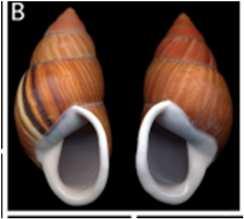 antero-posterior