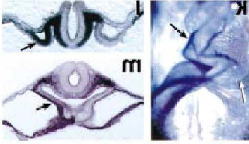 Pitx2 está no lado esquerdo do tubo cardíaco Pitx2: proteína nuclear, fator de transcrição Esq Dir Esq Dir Que experimento demonstraria que Pitx2 é suficiente para determinar o eixo LD?