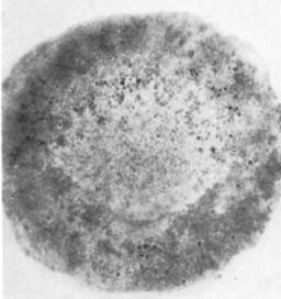 Recémfertilizado Mesoblástula