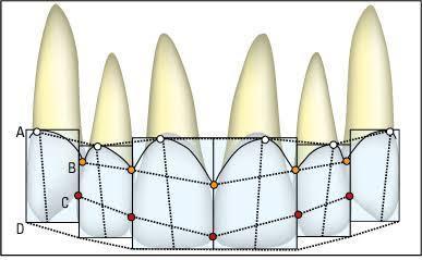 Figura 5 Linhas de referências estéticas:linha Cervical (A); Linha Papilar (B); Linha dos pontos de contato (C) e Linha Incisal (D) A relação da linha papilar com a linha dos pontos de contato criará