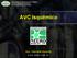 FACULDADE DE MEDICINA/UFC-SOBRAL MÓDULO SISTEMA NERVOSO NEUROANATOMIA FUNCIONAL. AVC Isquêmico. Acd. Gabrielle Holanda. w w w. s c n s. c o m.