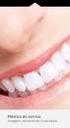 Recuperação da estética do sorriso: cirurgia plástica periodontal e reabilitação protética