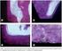 Evaluation of Bone Repair at the Interface of Titanium Plates and Screws