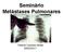 Seminário Metástases Pulmonares